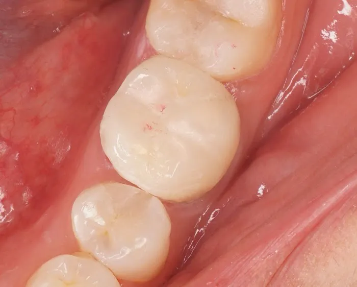 Alinea Dental Care Picture 3