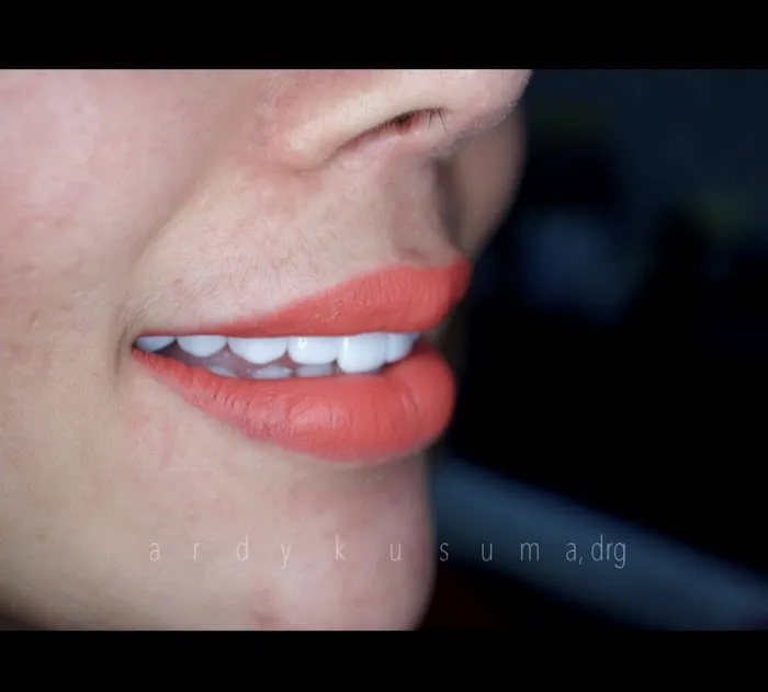 Alinea Dental Care Picture 6