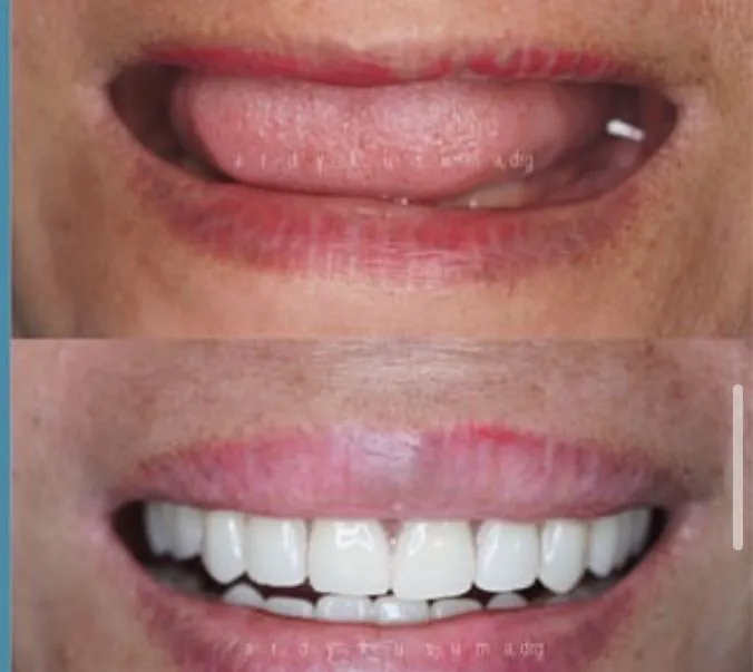 Alinea Dental Care Picture 2