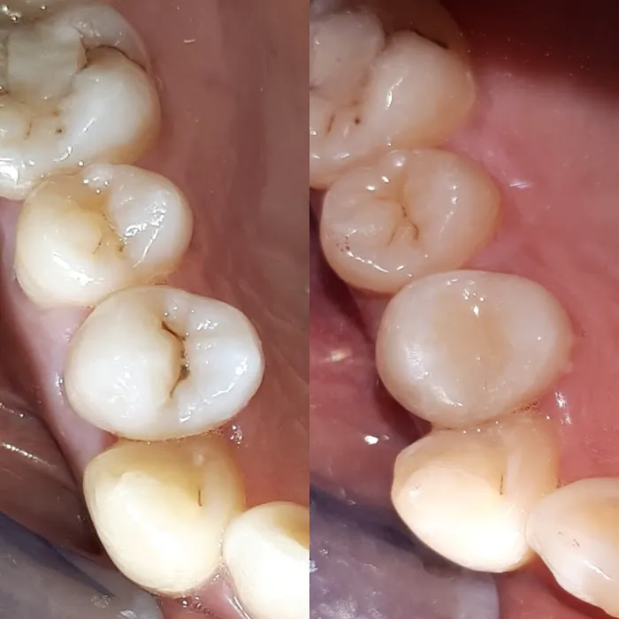 LUMIN DENTAL KLINIK GIGI & PRAKTEK DOKTER GIGI PALEMBANG Picture 4