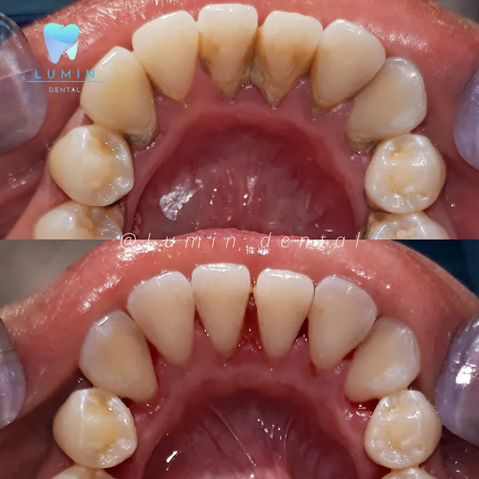 LUMIN DENTAL KLINIK GIGI & PRAKTEK DOKTER GIGI PALEMBANG Picture 10