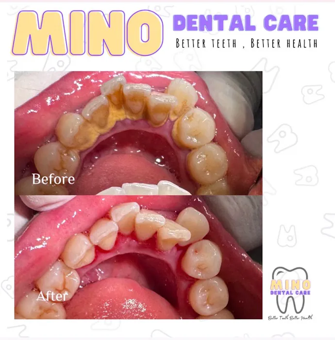Mino Dental Care Golf (drg.Ade Irma Suryani) Picture 7