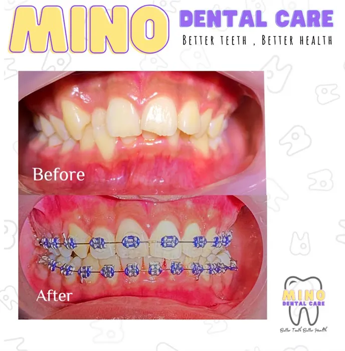 Mino Dental Care Golf (drg.Ade Irma Suryani) Picture 9