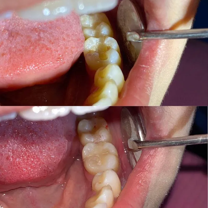 Dokter Gigi Terdekat Edental | Pasang Behel Gigi Palembang Sekip Picture 5