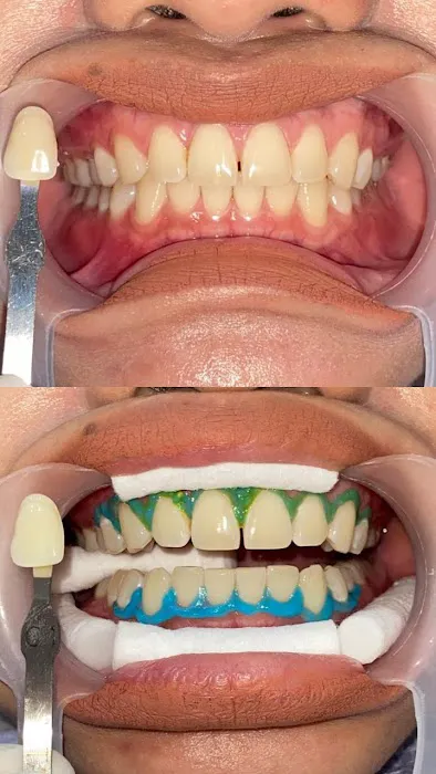 Dokter Gigi Terdekat Edental | Pasang Behel Gigi Palembang Sekip Picture 7