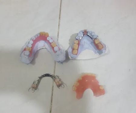 Bikin Gigi Mustika