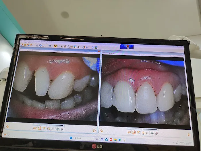 Klinik Gigi Irene Dental Care Picture 5