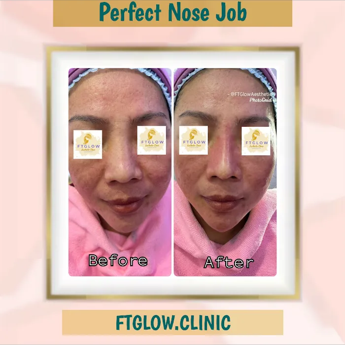 FTGLOW AESTHETIC CLINIC Picture 10