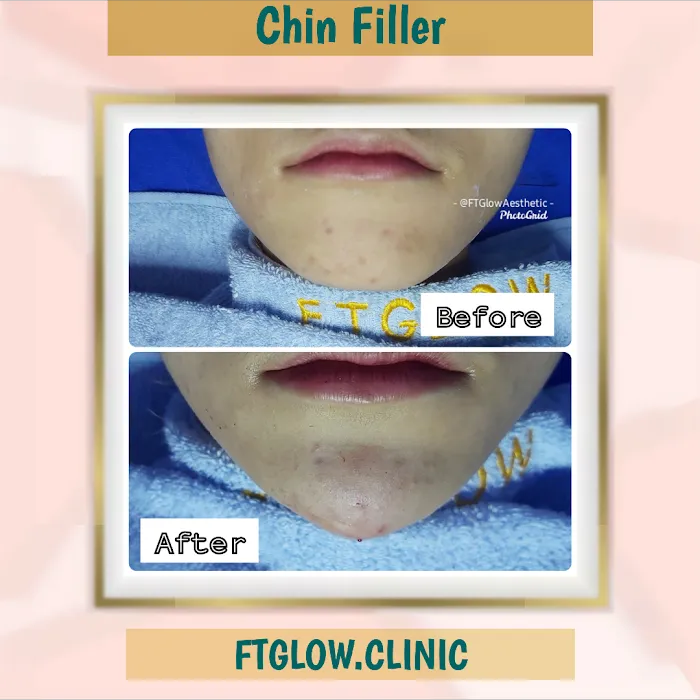 FTGLOW AESTHETIC CLINIC Picture 9