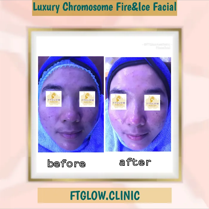 FTGLOW AESTHETIC CLINIC Picture 7