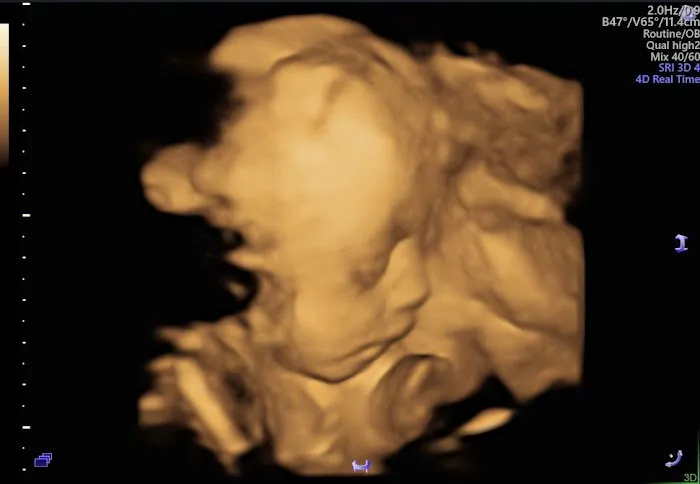 dr. Eric Tjahyadi, SpOG Picture 1