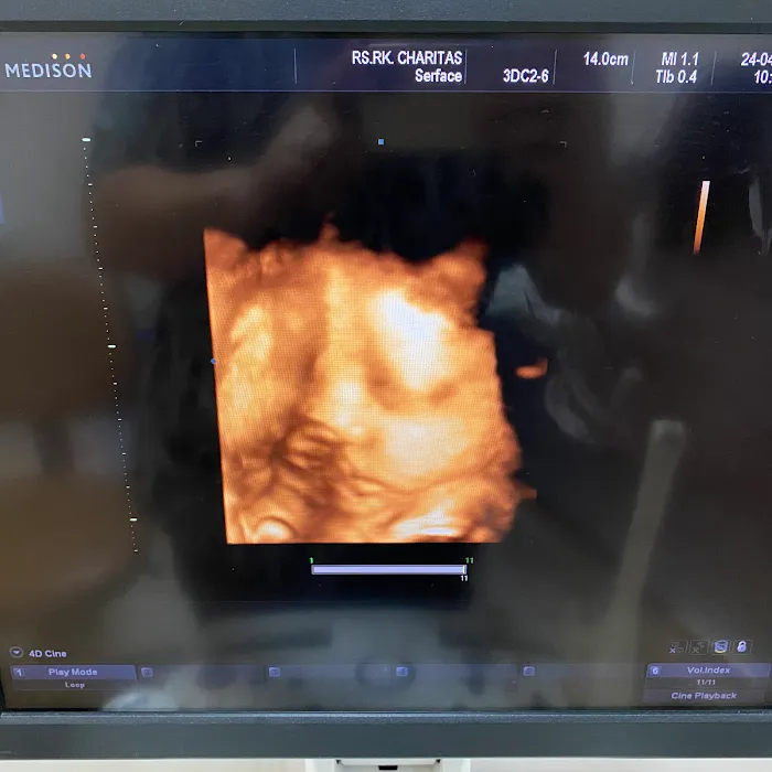 dr. Eric Tjahyadi, SpOG Picture 7