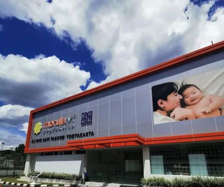 Morula IVF Yogyakarta