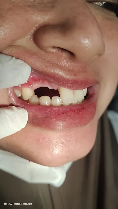 EDI DENTAL Condongcatur Picture 3
