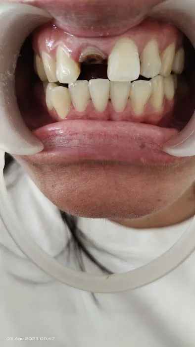 EDI DENTAL Condongcatur Picture 4