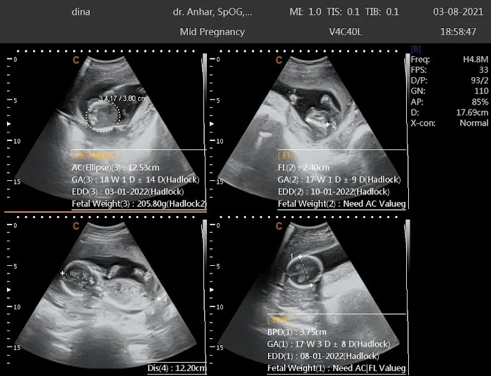 Klinik Arissa Praktek dr. Kms. Anhar, SpOG, MARS Picture 4