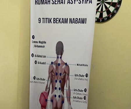 Rumah Sehat Asy Syifa Bekam dan akupuntur Palembang