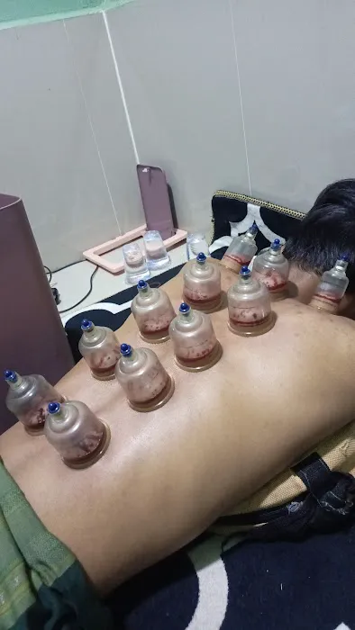 Bekam sehat Picture 5
