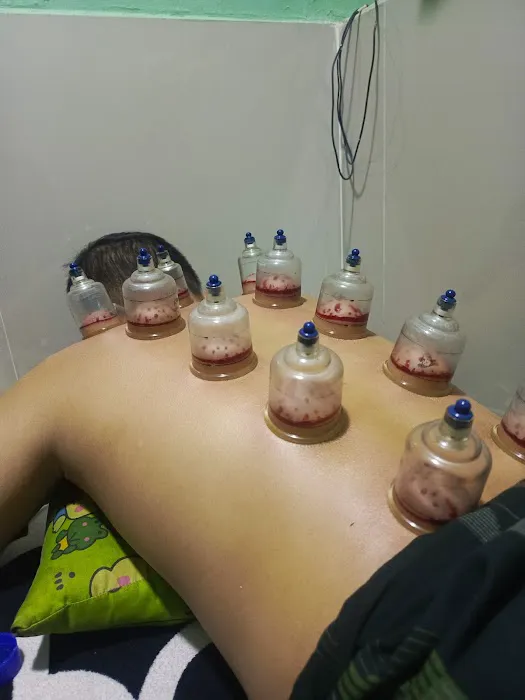 Bekam sehat Picture 6