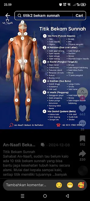 Bekam sehat Picture 3