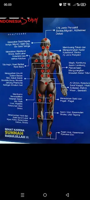 Bekam sehat Picture 2