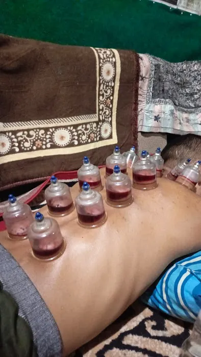 Bekam sehat Picture 8