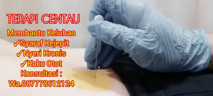 Terapi Syaraf Kejepit Akupuntur Centau Tabib Roy Picture 1
