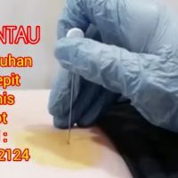 Terapi Syaraf Kejepit Akupuntur Centau Tabib Roy ico