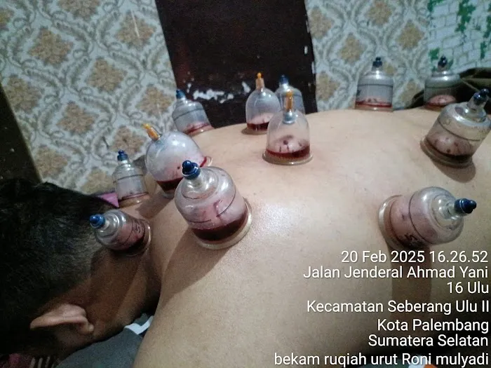 Bekam.ruqiah. urut kesehatan Roni mulyadi Picture 10