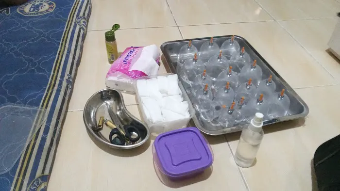Bekam dan pijat HomeCare (layanan ke Rumah) Picture 2
