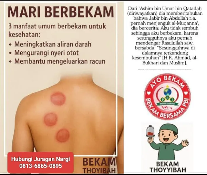 Bekam dan pijat HomeCare (layanan ke Rumah) Picture 1