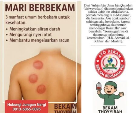 Bekam dan pijat HomeCare (layanan ke Rumah)