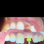 Mino Dental Care Kalidoni (drg.Ade Irma Suryani)