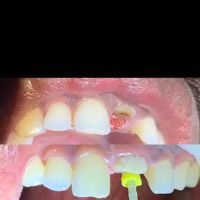 Mino Dental Care Kalidoni (drg.Ade Irma Suryani) ico