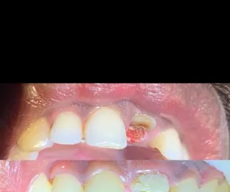 Mino Dental Care Kalidoni (drg.Ade Irma Suryani)