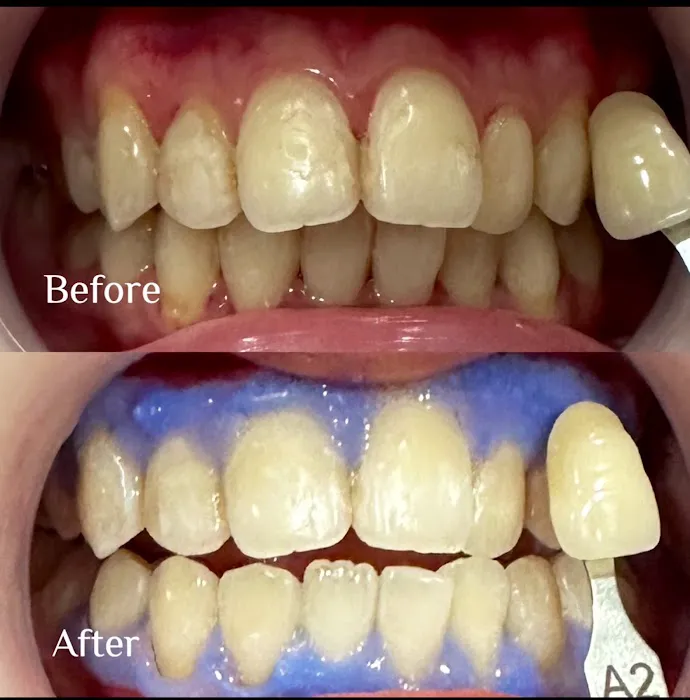Mino Dental Care Kalidoni (drg.Ade Irma Suryani) Picture 7