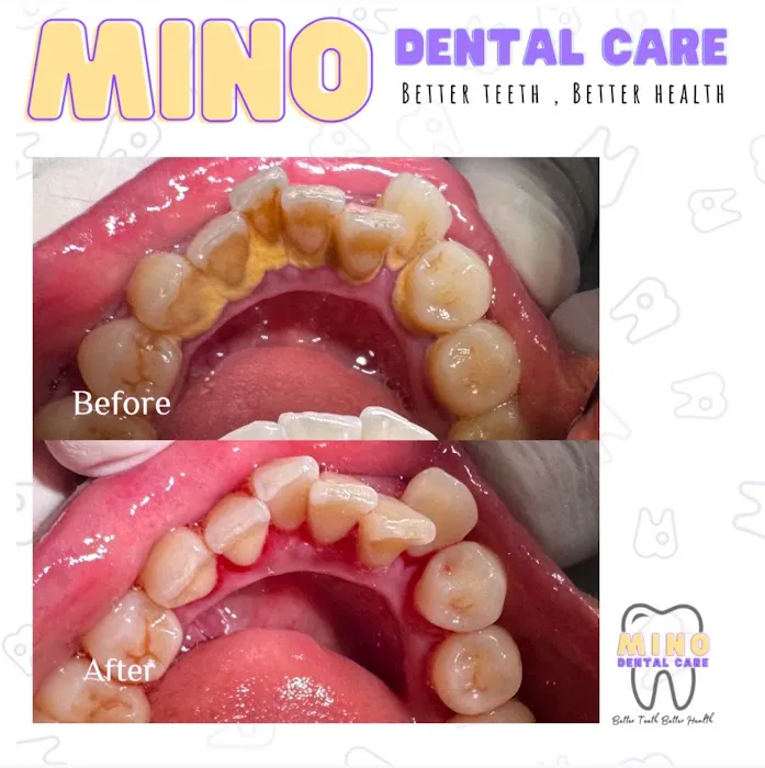 Mino Dental Care Kalidoni (drg.Ade Irma Suryani) Picture 6