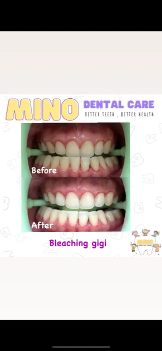 Mino Dental Care Kalidoni (drg.Ade Irma Suryani) Picture 2