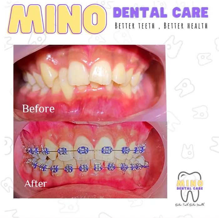 Mino Dental Care Kalidoni (drg.Ade Irma Suryani) Picture 5