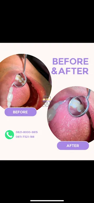 Mino Dental Care Kalidoni (drg.Ade Irma Suryani) Picture 8