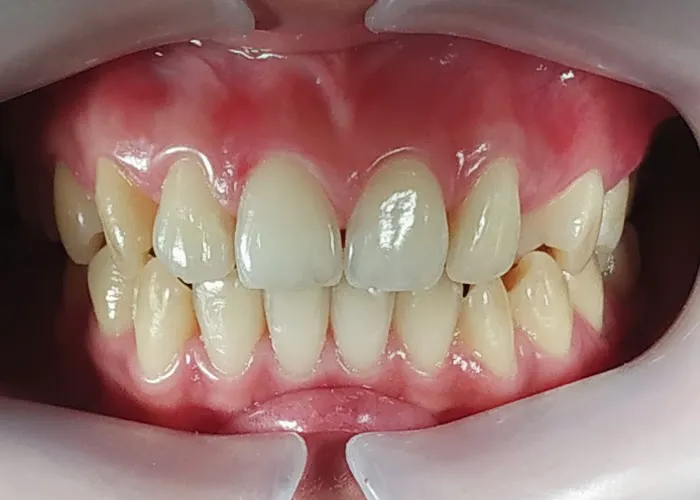 Klinik Gigi Zahara Dental Care | Dokter Gigi Palembang Picture 10