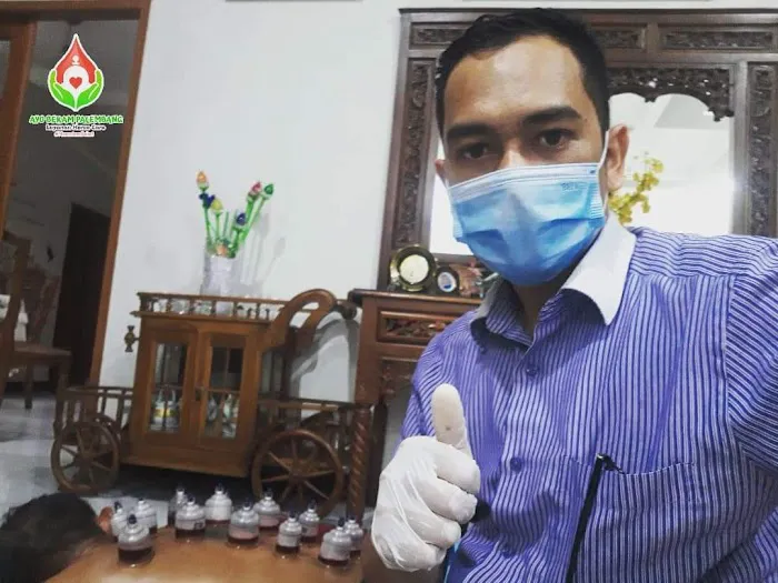 Bekam Palembang (Panggilan/ Home Care) Picture 5