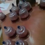 Bekam Palembang (Panggilan/ Home Care)