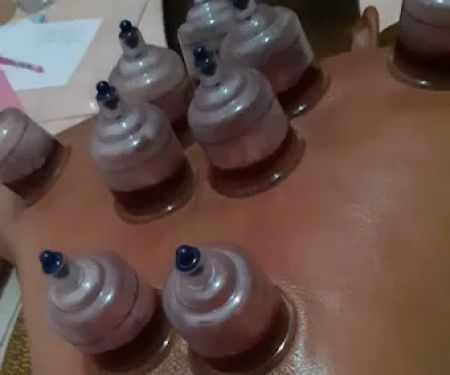 Bekam Palembang (Panggilan/ Home Care)