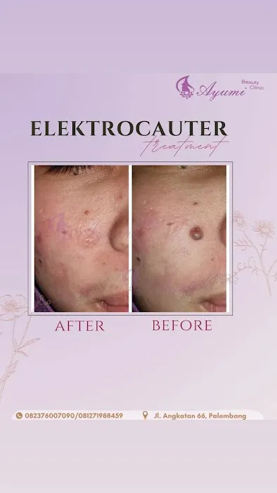 Klinik Kecantikan Ayumi Beauty Clinic Picture 8