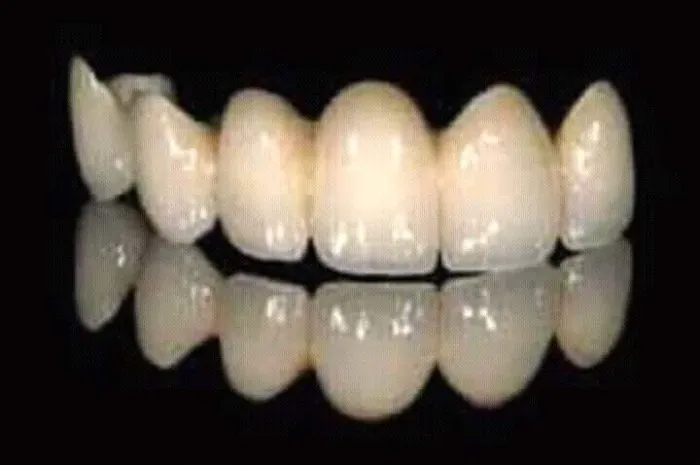 Kilnik Gigi Arman Picture 10