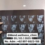 FISIOTERAPI, CEDERA OLAHRAGA DAN ANTROPOMETRI Ftr. SETYAWAN, AIFO., CMP., CDNP