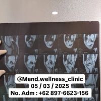 FISIOTERAPI, CEDERA OLAHRAGA DAN ANTROPOMETRI Ftr. SETYAWAN, AIFO., CMP., CDNP ico