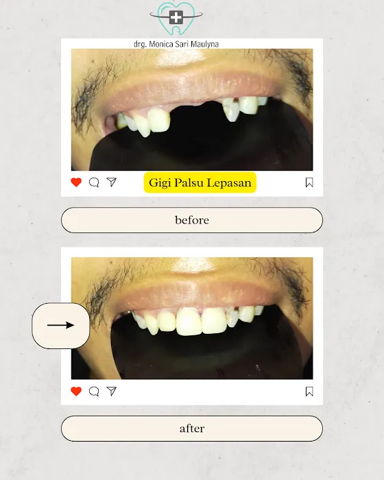 Modera Dental by drg Monica Sari Maulyna Picture 10