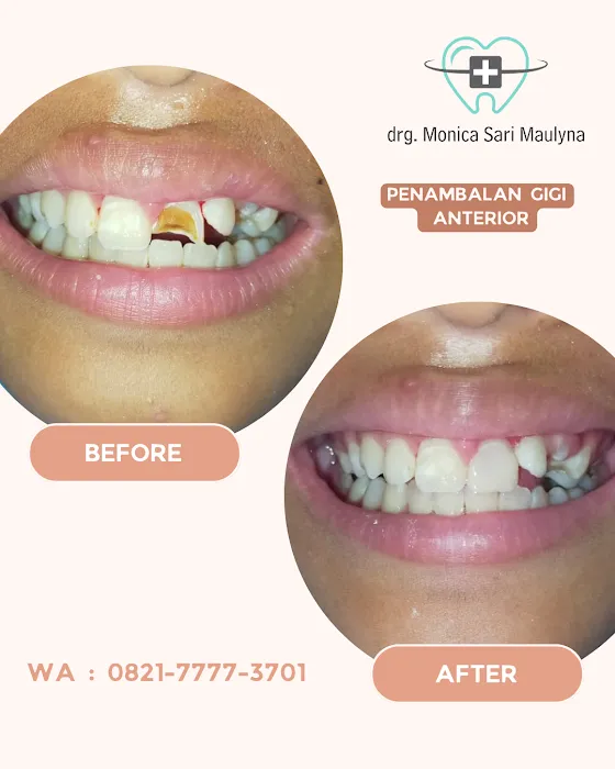 Modera Dental by drg Monica Sari Maulyna Picture 8